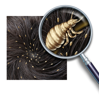 Head lice.jpg